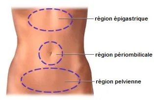 Diagnostic des Douleurs Pelviennes Chroniques : Comprendre et Traiter
