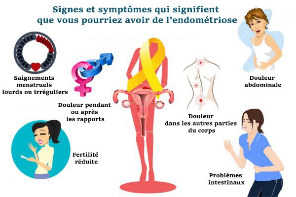 Endométriose : Témoignages au Maroc, Diagnostic Précoce et Traitements Disponibles
